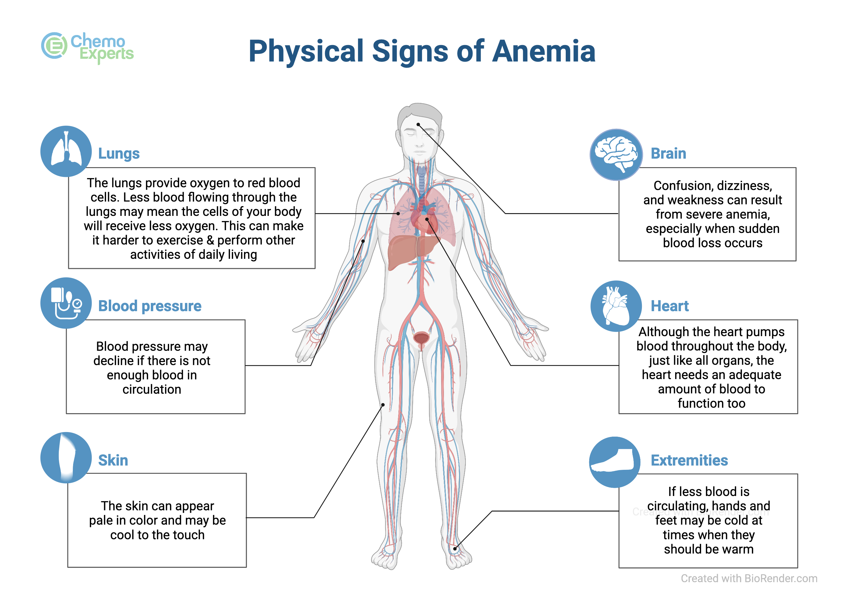 Anemia ChemoExperts